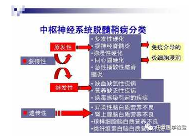 中枢神经系统脱髓鞘