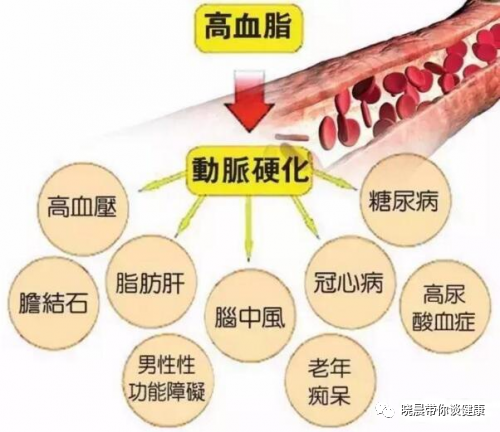 血脂检测仪什么牌子好逸捷血脂尿酸血糖血压检测仪：匠心产品为您的健康保驾护航_https://www.jmylbn.com_新闻资讯_第1张