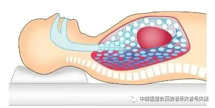 为什么血氧低要扣面罩居家血氧低？这一招可暂时提升血氧_https://www.jmylbn.com_新闻资讯_第5张