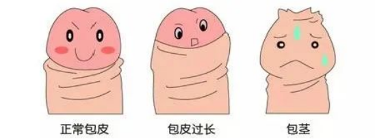 姐们儿,快暑假了!带娃割包皮吗?!-微信头条网 姐们儿,快暑假了!带娃割包皮吗?!