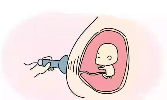 胎儿mt是什么检查什么疼吗妇幼科普：NT检查是什么？NT不过关宝宝就不能要吗？_https://www.jmylbn.com_新闻资讯_第7张