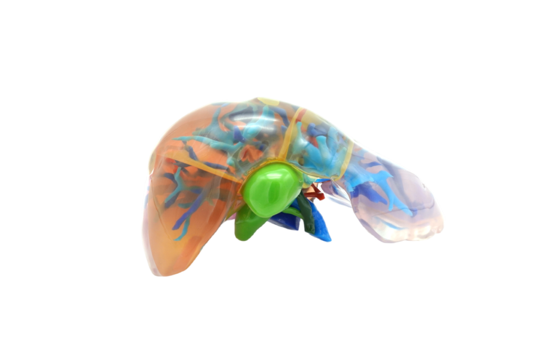 介入医学3D打印模型