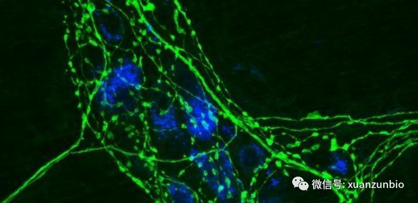 免疫荧光技术——直接法-学习中心-重庆宣尊生物科技有限公司-宣尊生物