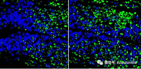 免疫染色过程中，荧光抗体如何选择更好？-学习中心-重庆宣尊生物科技有限公司-宣尊生物