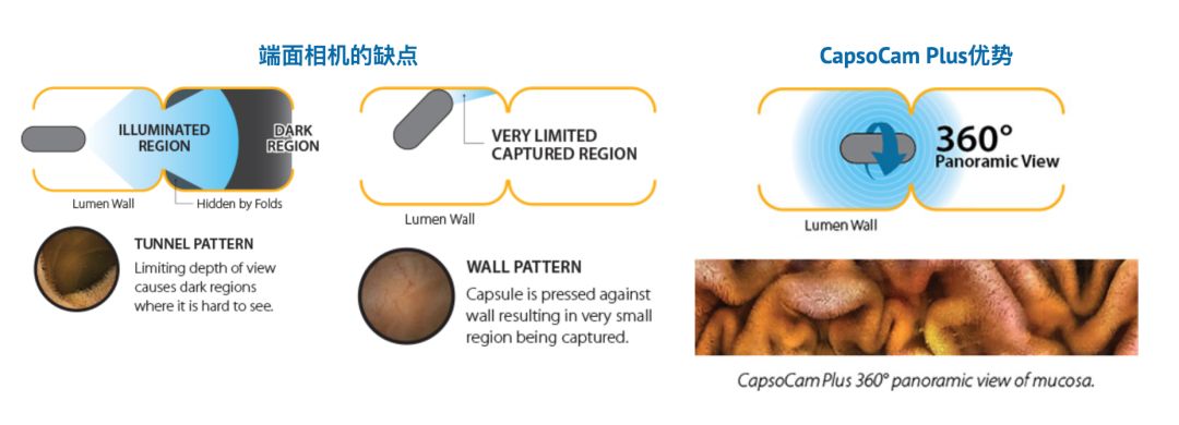 胶囊内镜品牌有哪些六大主流胶囊内镜，一次过饱眼福_https://www.jmylbn.com_新闻资讯_第11张