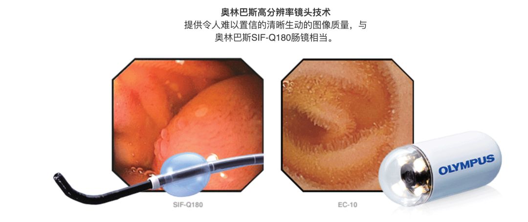 胶囊内镜品牌有哪些六大主流胶囊内镜，一次过饱眼福_https://www.jmylbn.com_新闻资讯_第4张