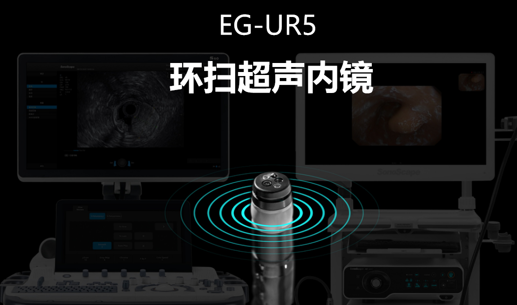 开立超声怎么导出图像国产首台！开立医疗超声内镜EG-UR5正式获批上市_https://www.jmylbn.com_新闻资讯_第2张
