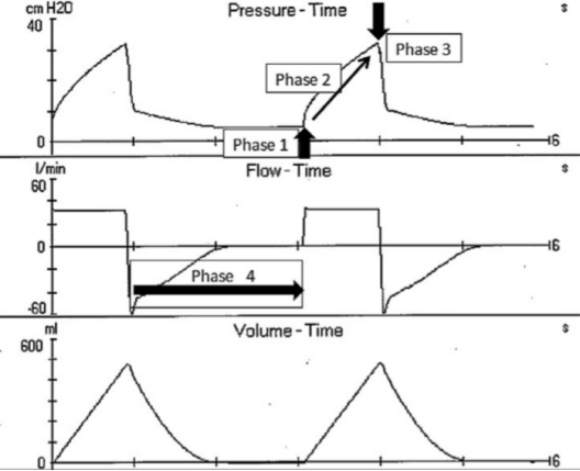 为什么呼吸机人机同步人机同步性概述_https://www.jmylbn.com_新闻资讯_第10张
