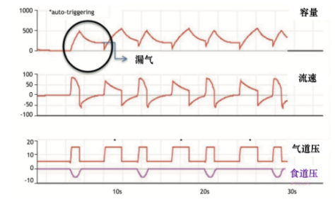 为什么呼吸机人机同步人机不同步的监测与识别_https://www.jmylbn.com_新闻资讯_第10张