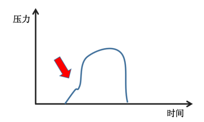为什么呼吸机人机同步人机不同步常见类型及处理策略_https://www.jmylbn.com_新闻资讯_第20张