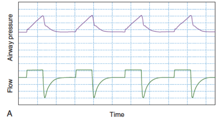 为什么呼吸机人机同步人机不同步常见类型及处理策略_https://www.jmylbn.com_新闻资讯_第17张