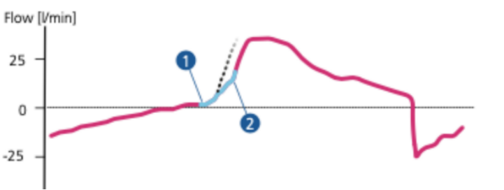 为什么呼吸机人机同步人机不同步常见类型及处理策略_https://www.jmylbn.com_新闻资讯_第4张