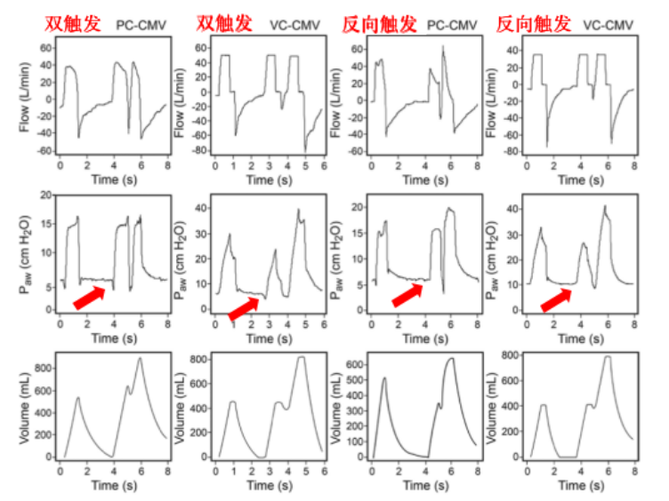 为什么呼吸机人机同步人机不同步常见类型及处理策略_https://www.jmylbn.com_新闻资讯_第26张