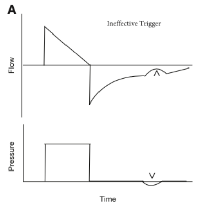 为什么呼吸机人机同步人机不同步常见类型及处理策略_https://www.jmylbn.com_新闻资讯_第9张