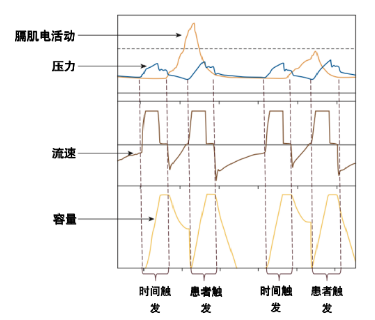 为什么呼吸机人机同步人机不同步常见类型及处理策略_https://www.jmylbn.com_新闻资讯_第25张