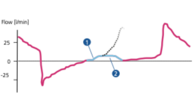 为什么呼吸机人机同步人机不同步常见类型及处理策略_https://www.jmylbn.com_新闻资讯_第5张