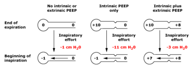 为什么呼吸机人机同步人机不同步常见类型及处理策略_https://www.jmylbn.com_新闻资讯_第7张