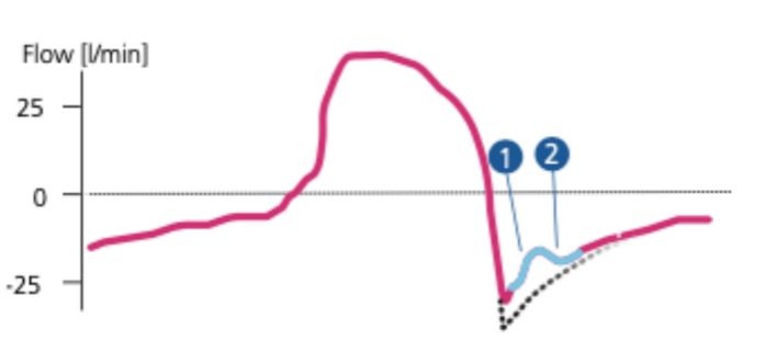 为什么呼吸机人机同步人机不同步常见类型及处理策略_https://www.jmylbn.com_新闻资讯_第28张