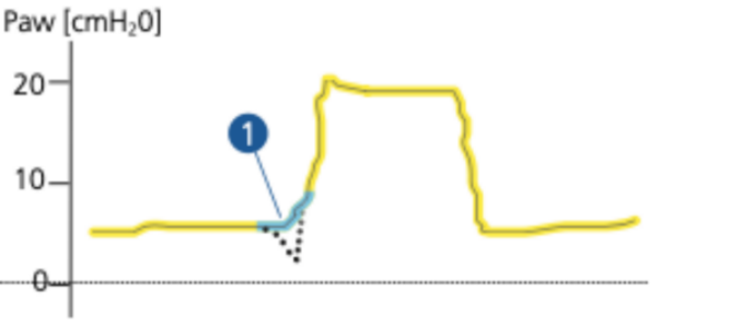 为什么呼吸机人机同步人机不同步常见类型及处理策略_https://www.jmylbn.com_新闻资讯_第12张
