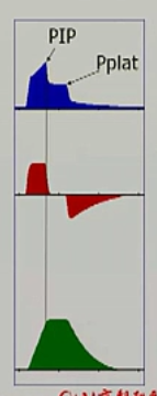 呼吸机pip是什么意思呼吸机参数之峰压（PIP）与平台压（Pplat）_https://www.jmylbn.com_新闻资讯_第2张