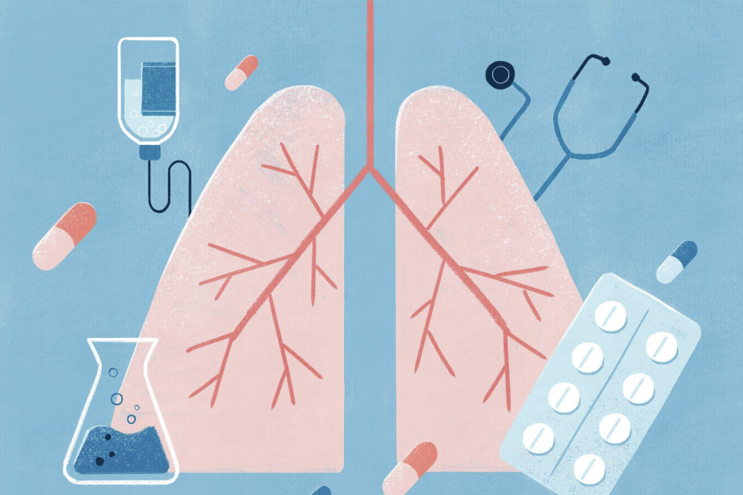 怎么选制氧机小白避坑！制氧机这样选！_https://www.jmylbn.com_新闻资讯_第3张