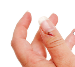 医院DR怎么消毒液体创可贴：促进湿性愈合，消毒防护，有娃必备！_https://www.jmylbn.com_新闻资讯_第22张