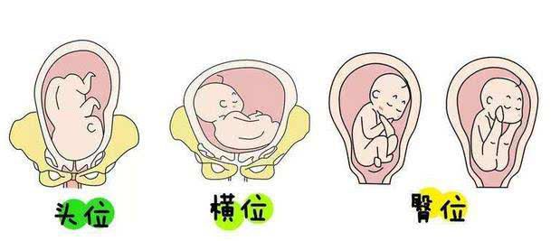 如果宝宝在妈妈的肚子里是横胎位的话,准妈妈的肚子看起来就会比较大
