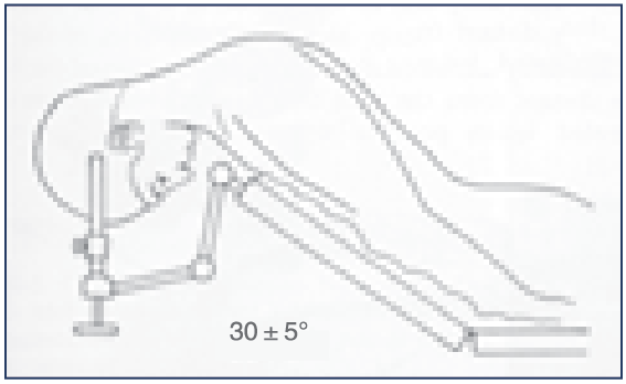 气管插管的管是什么气管插管那些事，一文帮你搞定_https://www.jmylbn.com_新闻资讯_第19张