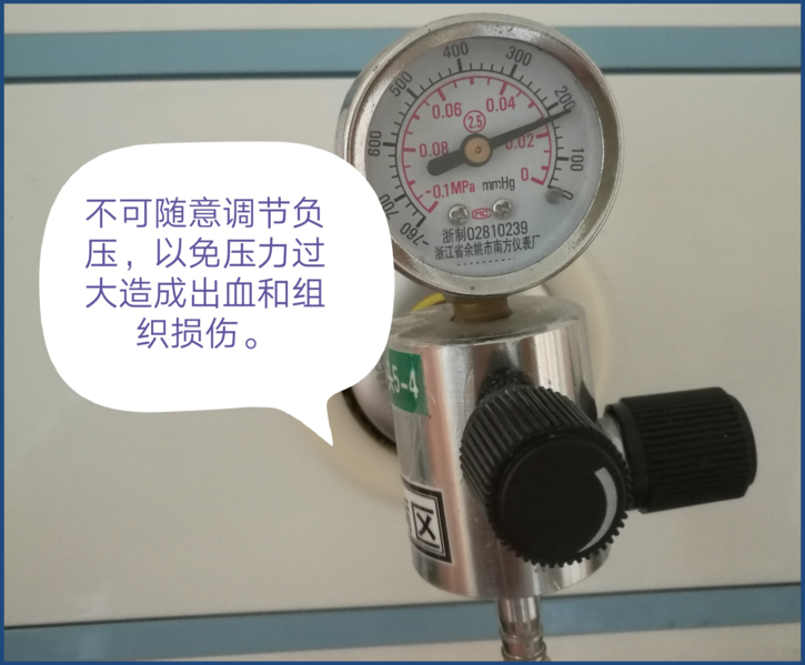 为什么负压引流健康教育系列《外科篇》22——负压封闭引流术_https://www.jmylbn.com_新闻资讯_第8张