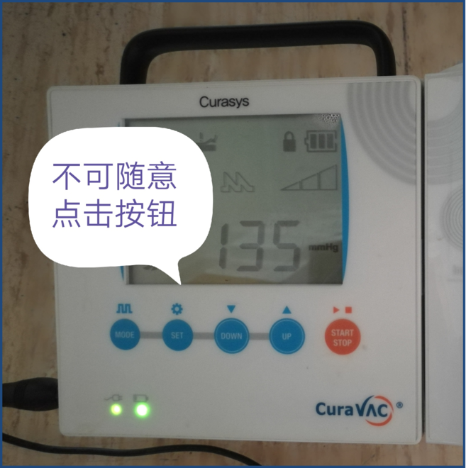 为什么负压引流健康教育系列《外科篇》22——负压封闭引流术_https://www.jmylbn.com_新闻资讯_第7张