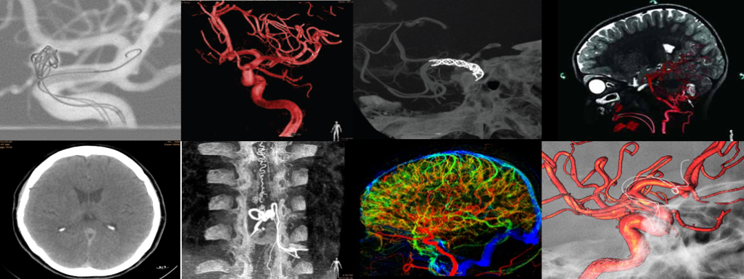 医用仪器有哪些能透视让疾病无处遁形，带你瞧瞧医院里的“火眼金睛”_https://www.jmylbn.com_新闻资讯_第10张
