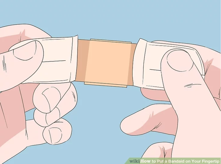 伤口贴敷料为什么创可贴VS创口贴VS医用敷料贴，别傻傻分不清_https://www.jmylbn.com_新闻资讯_第6张