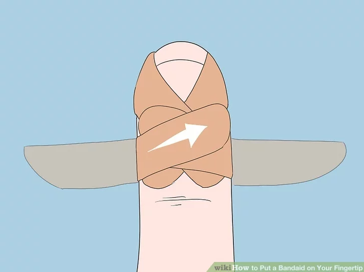 伤口贴敷料为什么创可贴VS创口贴VS医用敷料贴，别傻傻分不清_https://www.jmylbn.com_新闻资讯_第9张