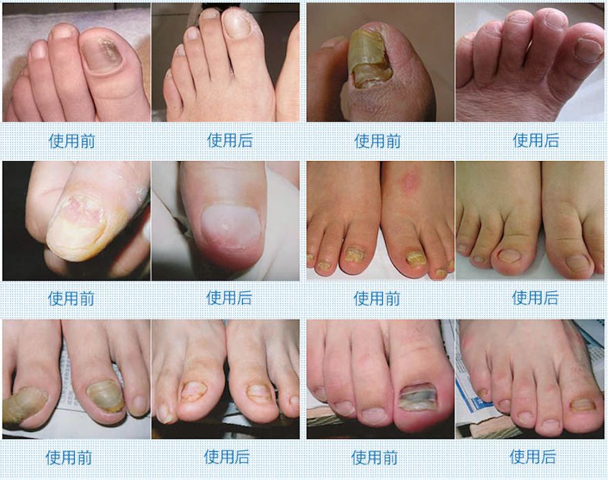 ����ȫŷ�޵Ļ�ָ�ױʣ�7�����Ч��20����̻�ָ��Ҳ�ܾȣ�