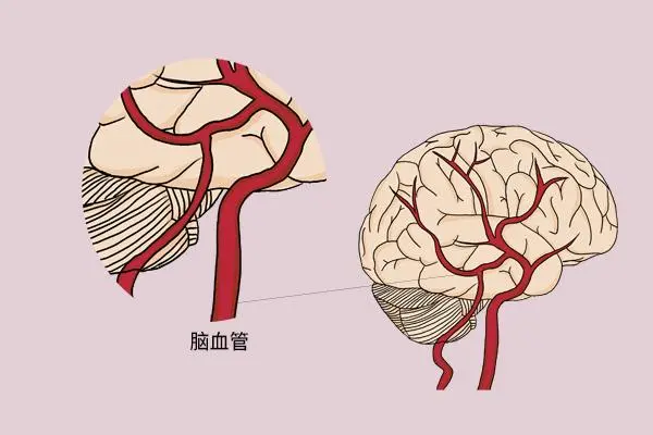 脑血管图片卡通图片