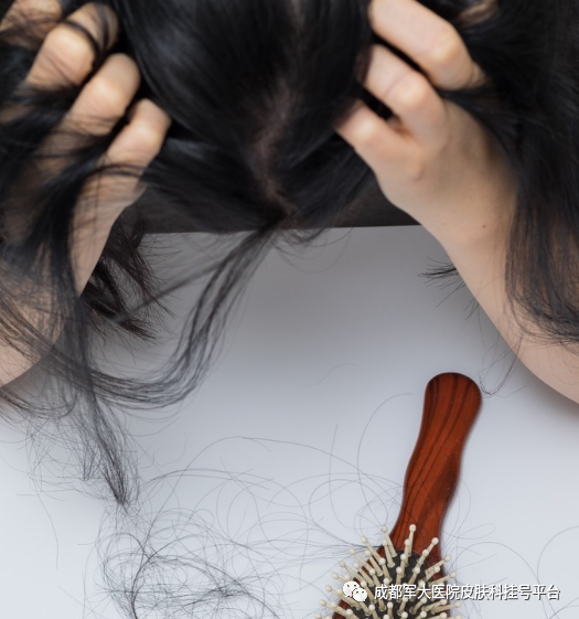 女人严重脱发,有可能是这几个原因