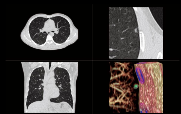 联影ct怎么样【仁合诊疗】我院引进联影高端128层CT正式投入使用_https://www.jmylbn.com_新闻资讯_第9张