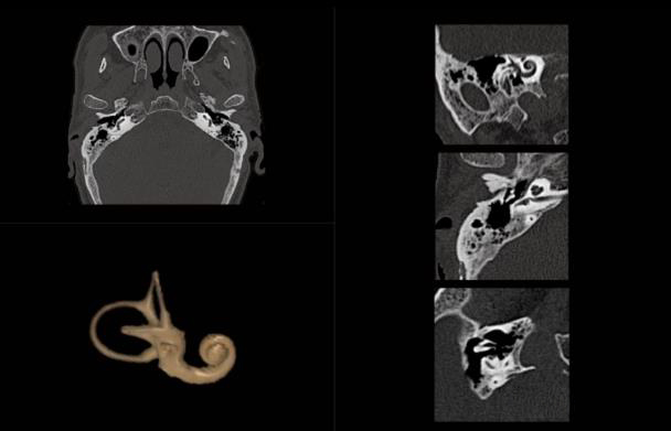 联影ct怎么样【仁合诊疗】我院引进联影高端128层CT正式投入使用_https://www.jmylbn.com_新闻资讯_第11张
