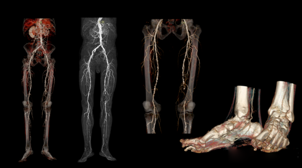 联影ct怎么样【仁合诊疗】我院引进联影高端128层CT正式投入使用_https://www.jmylbn.com_新闻资讯_第4张