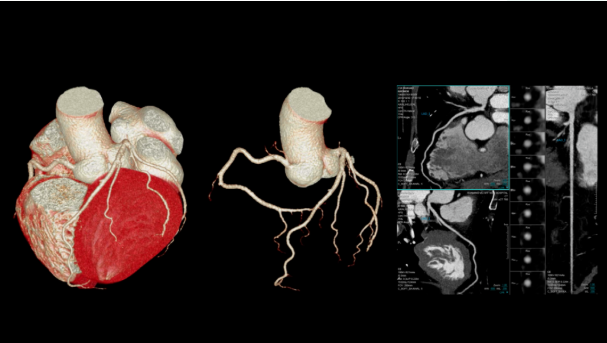 联影ct怎么样【仁合诊疗】我院引进联影高端128层CT正式投入使用_https://www.jmylbn.com_新闻资讯_第6张