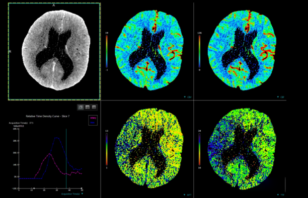 联影ct怎么样【仁合诊疗】我院引进联影高端128层CT正式投入使用_https://www.jmylbn.com_新闻资讯_第7张