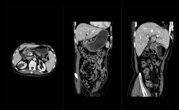 联影ct怎么样【仁合诊疗】我院引进联影高端128层CT正式投入使用_https://www.jmylbn.com_新闻资讯_第8张