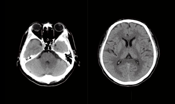 联影ct怎么样【仁合诊疗】我院引进联影高端128层CT正式投入使用_https://www.jmylbn.com_新闻资讯_第10张