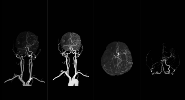 联影ct怎么样【仁合诊疗】我院引进联影高端128层CT正式投入使用_https://www.jmylbn.com_新闻资讯_第5张