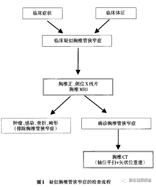 胸椎管狭窄症的临床特征与诊治要点 前松健康频道 微信公众号文章阅读 Wemp