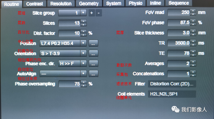 磁共振矩阵怎么计算磁共振——参数篇—（信噪比）_https://www.jmylbn.com_新闻资讯_第4张