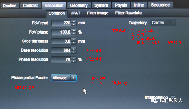 磁共振矩阵怎么计算磁共振——参数篇—（信噪比）_https://www.jmylbn.com_新闻资讯_第8张