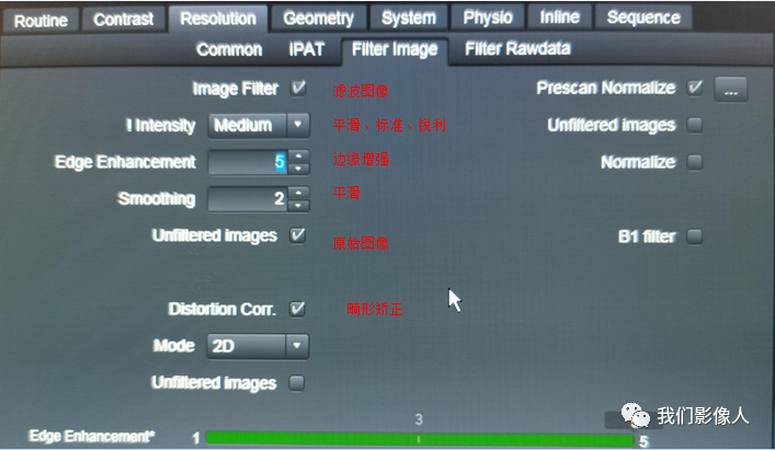 磁共振矩阵怎么计算磁共振——参数篇—（信噪比）_https://www.jmylbn.com_新闻资讯_第12张