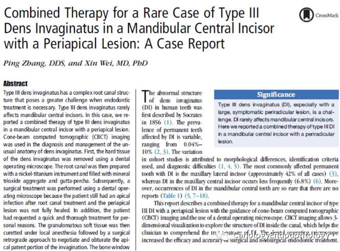 另外,2017年在aust dent j上发表了武汉大学和中山大学光华口腔医院的