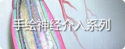 什么叫导引导管日问1715.《神介常识手册》第22期.什么是导引导管？_https://www.jmylbn.com_新闻资讯_第11张